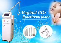 Co2 Fractional Laser Skin Resurfacing